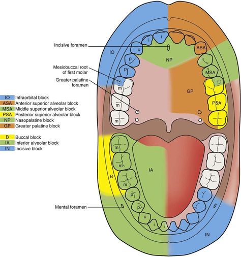 DentalEdge Youtube anesthesia videos-they're awesome! Dental Assistant Study Guide, Dental Anesthesia, Dental Hygiene Humor, Maxillary Nerve, Dental Terminology, Nerve Anatomy, Local Anesthesia, Dental Assistant Study, Dental Hygiene Student