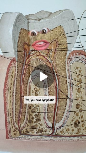 Leah Levitan | Lymph Literacy Advocate on Instagram: "Nearly 1/3 of lymph nodes in the body are located in the head and neck, and within the dentin (matrix of collagen fibers, aka: connective tissue) of each individual tooth we find blood, lymph, and nerves. 

The lymphatic system in our teeth:

🦷 Protects against infections in the mouth

🦷 Helps maintain bone density and the stability of the teeth

🦷 Removes excess fluid, proteins, and cellular debris to maintain a healthy environment

🦷 Supports the healing process and prevents chronic inflammation

Lymph from the gums, connective tissue, bone socket and teeth drains into the submandibular and submental lymph nodes under the jaw. Swollen lymph nodes there? Could be tooth related. 

👀 Look to the site of an old crown, root canal, or Swollen Lymph Node In Neck, Lymph Nodes Location, Collagen Fibers, Big Six, Connective Tissue, Lymph Nodes, Bone Density, Root Canal, Chronic Inflammation