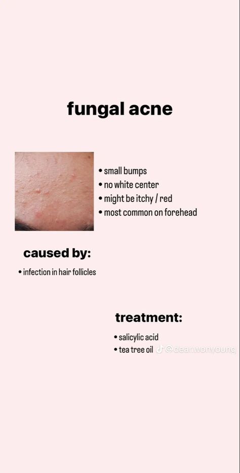 Esthetician Study Notes, Dermatology Aesthetic, Becoming An Esthetician, Skin Care Basics, Beauty Skin Quotes, Skin Therapist, Clear Healthy Skin, Skin Facts, Skin Advice