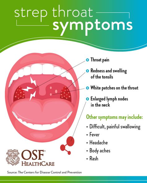 What to know about strep throat | OSF HealthCare Sour Throat, Strep Throat Symptoms, Scratchy Throat, Throat Pain, Throat Infection, Sick Remedies, Strep Throat, Healing Waters, Hand Hygiene