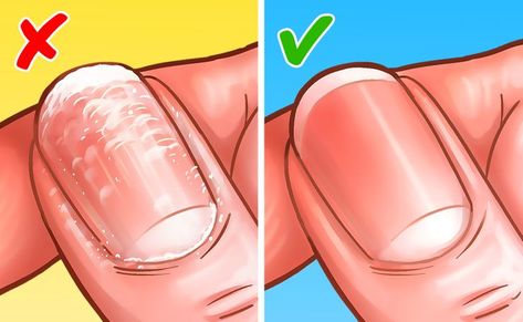 How to Remove Gel Nail Polish at Home How To Fix Nails After Gel Polish, Easiest Way To Remove Gel Nail Polish, How To Remove Gel Nail Polish, How To Soak Off Gel Nails, How To Remove Gel Polish At Home, Remove Gel Nails At Home, Gel Nail Polish At Home, Removing Gel Polish, Liquid Gel Nails