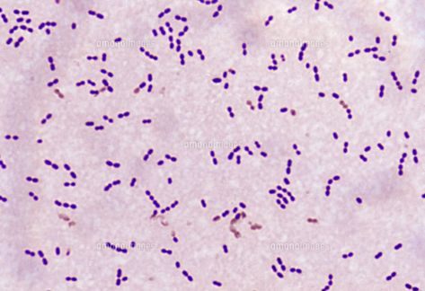 Streptococcus pneumoniae | Cocci in pairs | Gram (+) Streptococcus Agalactiae, Pathology Study, Microbiology Study, Streptococcus Pneumoniae, Microbiology Lab, Medical Laboratory Scientist, Medical Lab, Medical Laboratory Science, Biomedical Science