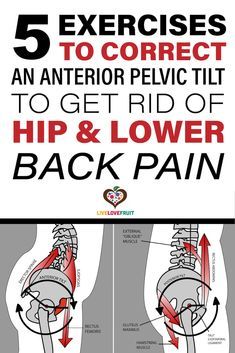 Anterior Pelvic Tilt, K Tape, Hip Flexor Exercises, Hip Pain Relief, Back Stretches For Pain, Pelvic Tilt, Lower Back Pain Exercises, Posture Exercises, Relieve Back Pain