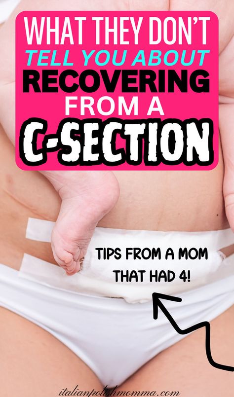 C section recovery tips and c section recovery must-haves, what to do before your c-section, post c-section care, c-section recovery essentials 2nd C Section Recovery, Post C Section Recovery, C Section Recovery Kit, C Section Recovery Essentials, Best Postpartum Belly Wrap, Postpartum Products, Recovering From C Section, C Section Recovery Timeline, C Section Belly