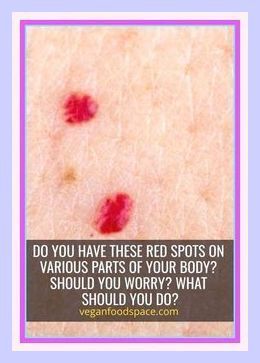 Do You Have These Red Spots On Various Parts Of Your Body? Red Spots On Skin How To Get Rid, How To Get Rid Of Cherry Angiomas, Red Dots On Skin, Red Moles On Skin, Red Spots On Legs, Red Spots On Skin, Red Spots On Face, Red Skin Spots, Rash Remedies