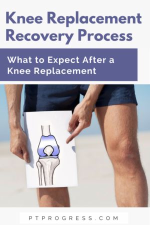 Pt For Knee Replacement, Exercises For Knee Replacement Patients, Recovering From Knee Replacement Surgery, Exercise After Knee Replacement, Exercises After Knee Replacement Surgery, Knee Replacement Humor, Knee Replacement Recovery Tips, Knee Replacement Surgery Recovery, Knee Recovery