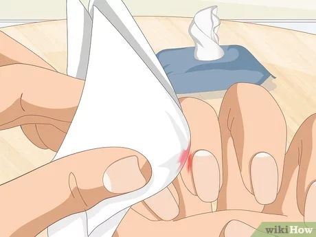 3 Ways to Heal Cuticles - wikiHow Heal Cuticles, Peeling Cuticles, Cuticle Repair, Hand Soak, Ways To Heal, Nail Infection, Hand Mask, Cuticle Care, Cuticle Remover