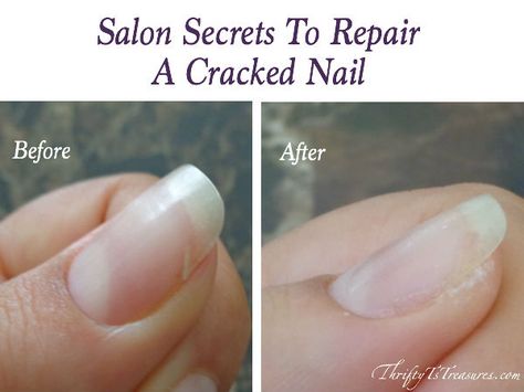 Shared from a nail tech, these salon secrets to repair a cracked nail are tried and true tips and techniques that you can use at home. There’s no need to head to the salon because you can DIY! Fix Cracked Nail, Fix Broken Nail, Repair Broken Nail, Cracked Nails, Nail Tek, No Chip Nails, Broken Nails, Easy Nails, Nail Repair