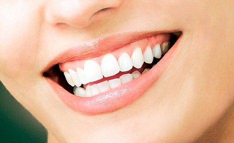 I put to you: A smile is the best accessory a woman can own. Negativity is so ugly. What Is Oil Pulling, Baking Soda Health, Bone Grafting, Laser Dentistry, Kedokteran Gigi, Laser Teeth Whitening, Porcelain Veneers, Best Teeth Whitening, Receding Gums