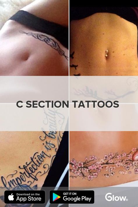 Tattoo For C Section Scar, Caesarean Section Tattoo, C Section Tattoo Cover Up, Tummy Tucks Tattoo Cover Up, Tuck Tattoos, C Section Scar Tattoo, C Section Tattoo, Maple Leaf Tattoos, C Section Scars