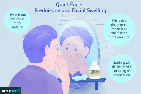 Moon Face: Facial Swelling Caused by Prednisone Face Swelling Causes, Moon Face Swelling, Prednisone Moon Face, Face Swelling, Facial Swelling, Effective Management, Chest Congestion, School Info, Holistic Care