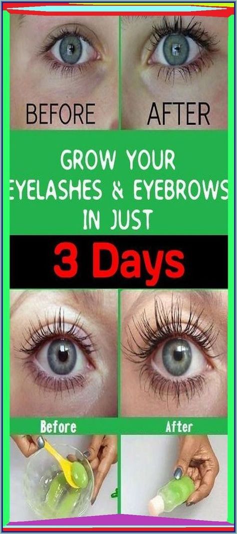 Thick Eyebrows And Eyelashes, Grow Your Eyelashes, Lashes Grow, Grow Eyebrows, Eyelashes Longer, Grow Eyelashes, Eyebrows And Eyelashes, Get Thick, Brow Growth