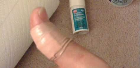 close-up of bandaged finger Infected Cut, Home Cleaning Hacks, Fun Recipes, Home Cleaning, Hacks Diy, Health And Beauty Tips, Home Health, Health Diet, Simple Tricks