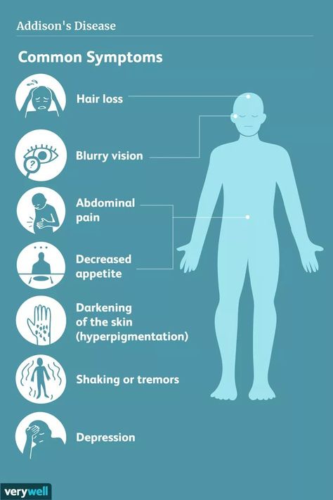 Congenital Adrenal Hyperplasia, Addison's Disease, Intravenous Fluids, Addisons Disease, Skin Hyperpigmentation, Disease Symptoms, Adrenal Glands, Genetic Disorders, Hormone Replacement