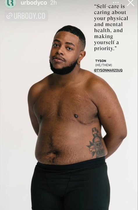 Top Surgery Plus Size, Trans Solidarity, Packer Ftm, Top Surgery Scars, Trans Masc, Top Surgery, Anatomy References, Male Anatomy, Make Yourself A Priority