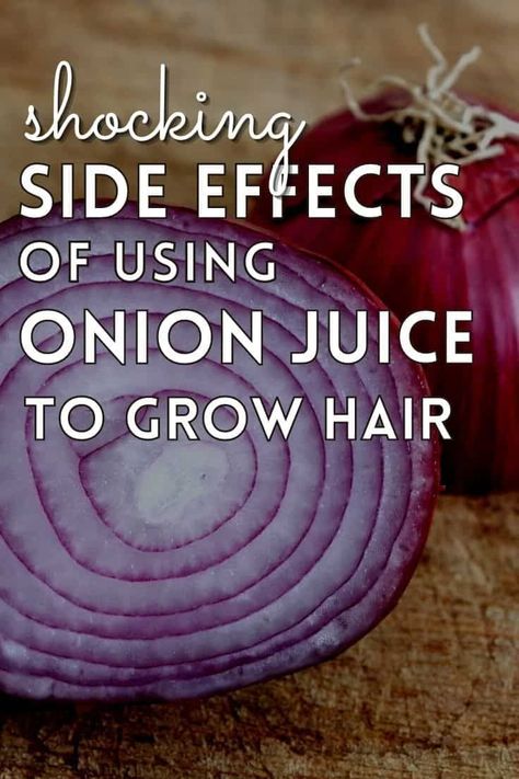 Hair Growth Onion Juice, Onion Remedy For Hair Growth, Juices For Hair Growth, Onion Oil Benefits, Onion And Aloe Vera For Hair Growth, Drinking Onion Water Benefits, Rosemary Onion Hair, Onion Oil For Hair Growth Diy, How To Make Onion Water For Hair Growth