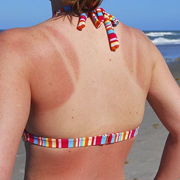 No one has to know about that time you fell asleep on the beach. How To Even Out Tan Lines, How To Get Rid Of Tan Lines, Tanning Lines, Bad Tan Lines, Get Rid Of Tan, Home Remedies For Sunburn, Natural Remedies For Sunburn, Sunburn Remedies, How To Tan Faster