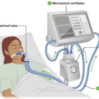 Mechanical ventilation is a critical component of modern healthcare, providing life-saving support to patients who cannot breathe adequately on their own. For nursing professionals, mastering the principles and practices of mechanical ventilation is essential, especially when preparing for the NCLEX exam. This guide will cover the fundamental aspects of mechanical ventilation, including basic principles, modes, settings, monitoring, complications, nursing considerations, and study resources. ... Nclex Exam, Mechanical Ventilation, Professional Nurse, Study Resources, Nclex, Saving Lives, Nursing, Health Care