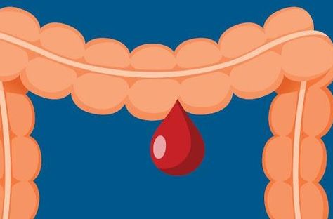 Cell Forms, Internal Organs, Digestive Tract, Reflux Disease, Large Intestine, Chest Pain, Abdominal Pain, Medical Conditions, The Help