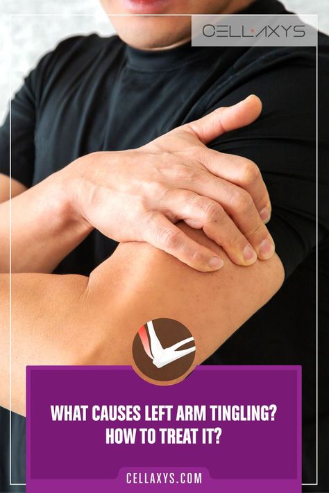 What Causes Left Arm Tingling? How To Treat It Arm Muscle Pain, Pins And Needles Feeling, Arm Numbness, Feeling Numb, Arm Muscles, Muscle Spasms, Pins And Needles, Nerve Pain, Muscle Pain