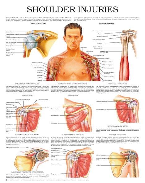 Shoulder injuries – Anejo Knee Fracture, Shoulder Rehab Exercises, Shoulder Anatomy, Rotator Cuff Exercises, Shoulder Pain Exercises, Vintage Nursing, Rehab Exercises, Shoulder Rehab, Knee Ligaments