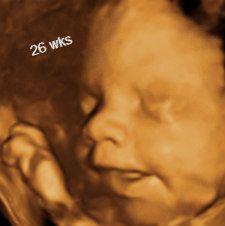 Clear 3D/4D Ultrasounds OBaby! Murfreesboro, TN 26 weeks Pregnancy By Month, 5th Month Of Pregnancy, Gender Determination, 3d Ultrasound, 4d Ultrasound, Pregnancy Ultrasound, Ultrasound Pictures, Early Pregnancy, Second Trimester