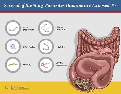 Parasite Infections: Functional Lab Analysis To Identify Parasites Full Moon Parasite Cleanse, Cleanse Your Gut, Die Off Symptoms, Full Moon Phase, Liver Fluke, Entamoeba Histolytica, Stomach Health, Parasitic Worms, Full Moon Phases