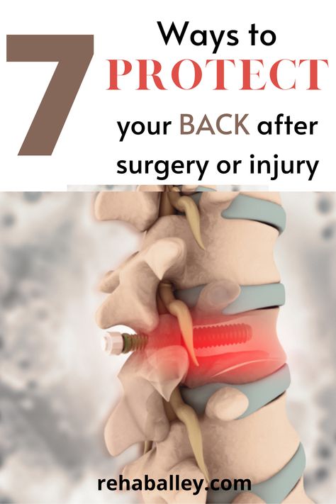 This picture displays a human spine with a screw going through it. This can be used as an example of a back surgery. Post Spinal Fusion Workout, Lumbar Surgery Recovery, Herniated Disk Surgery Recovery, Lower Back Injury Recovery, Back Injury Exercises Recovery, Back Strengthening Exercises After Surgery, Back Injury Recovery, Back Injury Exercises, Lower Back Injury Workout