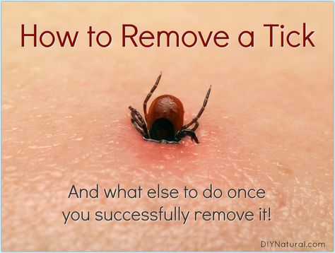 Do you know how to remove a tick? The other day I was bitten so I formulated this plan for a safe, natural removal. Here's how I did it and how you can too! Wood Tick, Get Rid Of Ticks, Tick Removal, Clean Baking Pans, Tick Bite, Tick Repellent, Cleaning Painted Walls, Glass Cooktop, Deep Cleaning Tips