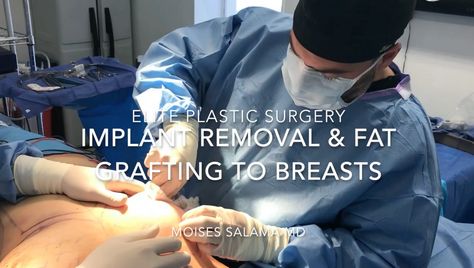 In our latest video, Dr. Salama performs breast implant removal with fat grafting. Breast Implant Removal, Implant Removal, Fat Grafting, Best Diets, Latest Video, Plastic Surgery, Surgery, Youtube Videos