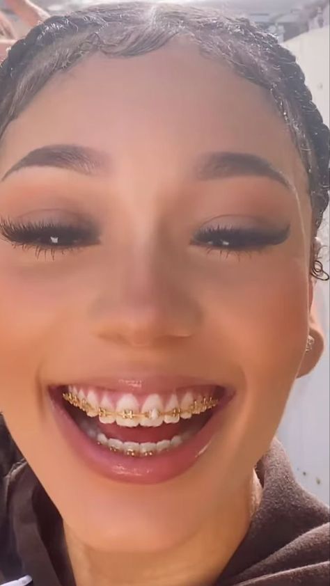 Gold Braces Teeth, Braces For Teeth, Jewelry Teeth, Braces Colors Ideas, Braces And Glasses, Gold Braces, Girl Grillz, Teeth Gems, Delicious Healthy Food