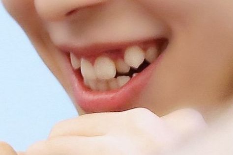 verivery- yeonho smile teeth Teeth Smile Reference, Natural Sharp Canine Teeth Human, Canine Teeth Human Aesthetic, Animal Teeth Aesthetic, Canine Teeth Human Smile, Teeth Types, Rabbit Teeth Smile, Types Of Teeth, Rabbit Teeth