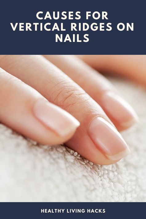 While vertical nail ridges may sometimes reveal a nutrient deficiency, they commonly occur as a normal sign of aging. Ridges In Fingernails Vertical, Nail Ridges Vertical Warning Signs, Ridges On Nails, Vertical Ridges On Fingernails, Vertical Nail Ridges, Split Nail Repair, Nail Ridges, Split Nails, Types Of Nail Polish