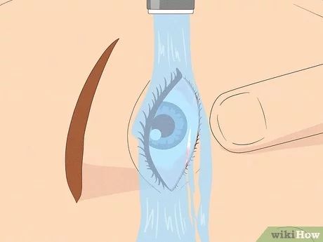 How to Stop Watery Eyes: Treatments, Causes & Precautions Eyes Watering, Irritated Eye, Eye Infections, Watery Eyes, Teary Eyes, Bacterial Infection, Deep Breathing Exercises, Beautiful Sea Creatures, Dry Eyes