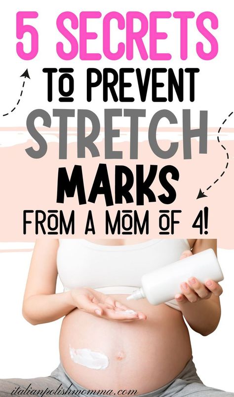 Pregnant woman applying stretch mark cream on her baby belly bump. Preventing Pregnancy Stretchmarks, Stretch Mark Pregnancy Prevent, Pregnancy Stretch Mark Routine, Stretch Mark Prevention Pregnancy, Stretch Mark Prevention, Strech Marks, How To Fade, Stretch Mark Removal, Stretch Mark Cream