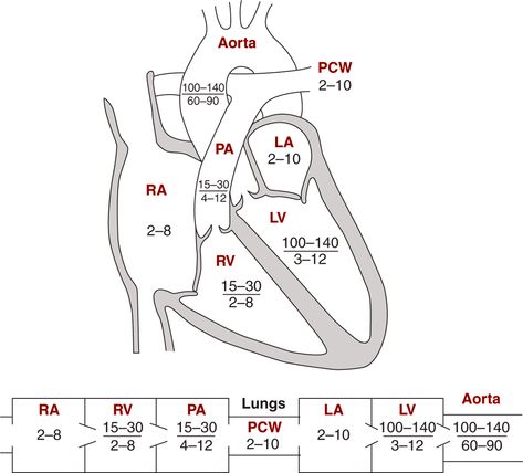 Image: Diagrams indicating normal pressures in the cardiac chambers &… Cath Lab Nursing, Cath Lab Nurse, Cardiac Sonography, Blood Pressure Chart, Cardiac Nursing, Critical Care Nursing, Respiratory Therapy, Nursing Tips, Nursing Study