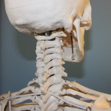 Cervical Lordosis, Healthy Curves, Skeletal Hand, Spinal Health, Medical Notes, Disk Herniation, Forward Head Posture, Aging Backwards, Cervical Spine