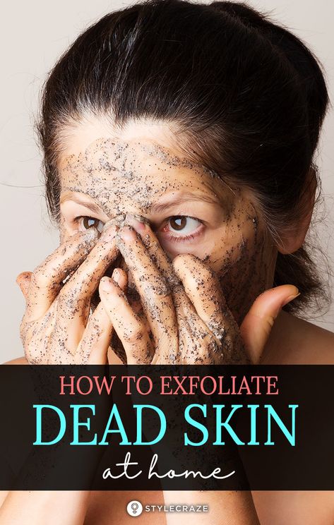 How To Remove Dead Skin Naturally? Blackheads And Whiteheads, Brown Spots On Face, Spots On Face, Glow Skin, Get Rid Of Blackheads, Flaky Skin, How To Exfoliate Skin, Clean Pores, Skin Skincare