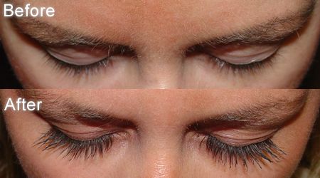 Latisse Before and after Lash Growing Serum, Grow Eyelashes Naturally, Grow Eyelashes, Lashes Serum, Eye Lashes Extensions, Eye Lashes Natural, Best False Eyelashes, Thick Hair Remedies, Lash Growth Serum