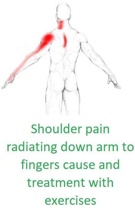 Pinched Nerve In Shoulder, Shoulder Pain Remedies, Neck Muscle Pain, Frozen Shoulder Exercises, Bag Of Ice, Bursitis Shoulder, Rotator Cuff Pain, Nerve Pain Remedies, Shoulder Rehab Exercises