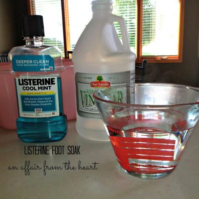 DIY Pedicure at Home - Listerine Foot Soak - Callus Remover Diy Pedicure At Home, Diy Pedicure Soak, Pedicure Soak, Best Callus Remover, Listerine Foot Soak, Listerine Mouthwash, Diy Pedicure, Pedicure At Home, Callus Remover