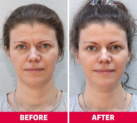 Yoga For Two, Face Lift Exercises, Facial Massage Routine, Face Yoga Exercises, Face Yoga Facial Exercises, Neck Exercises, Facial Yoga, February Nails, Face Exercises