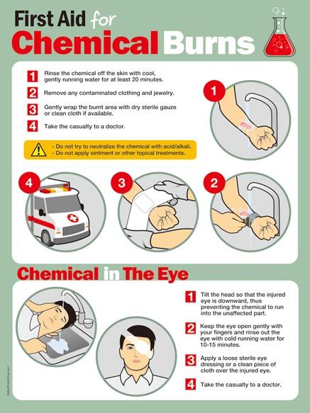 First Aid For Chemical Burns (2) | Safety Poster Shop First Aid Poster, First Aid Kit Checklist, Chemical Burn, First Aid Cpr, First Aid Tips, Safety Poster, Basic First Aid, Chemical Safety, Emergency First Aid