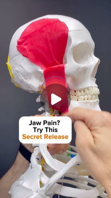 Dr. Joe Damiani - TMJ, Head & Neck Specialist on Instagram: "Have you been beating your master muscle into an oblivion?

 It’s pretty much your only strategy to release jaw, muscle pain and you’re just hammering away at it all day? 

Well, besides the Temporalis and Masseter, the Medial Pterygoid is one of the prime muscles involved in closing your mouth chewing or clenching. In this video, I show you how to get to that hard to reach Muscle to really push in there and Release Some Tension. 

I also show three separate strokes that you can use to get the most out of this release release in this muscle can help to decompress the TMJ and to make moving your mouth easier. 

🚨Most importantly, releasing muscles does not reverse TMJ disorder. It makes the muscles more healthy, but we must look How To Relax Jaw Muscles, Relax Jaw Muscles, Jaw Muscle Release, Scm Muscle Release, Temporalis Muscle, Leg Cramps Causes, Jaw Pain Relief, Masseter Muscle, Muscle Tension Relief