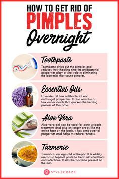 How To Get Rid Of Pimples (Acne) Overnight Fast #homeremdies #skincare #remedies #remedy #pimples Home Remedies For Pimples, Get Rid Of Pimples, Rid Of Pimples, Forehead Acne, Skincare Remedies, Acne Overnight, Pimples Overnight, Pimples Remedies, Skin Care Routine For 20s