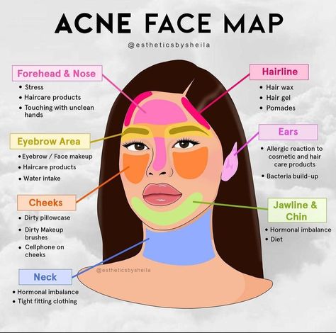 Face Map, Face Mapping Acne, Face Mapping, Skin Advice, Good Skin Tips, Basic Skin Care Routine, Clear Skin Tips, Perfect Skin Care Routine, Healthy Skin Tips