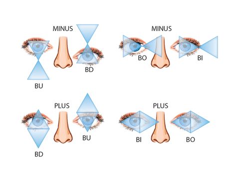 Optometrist Technician, Opthalmic Technician, Optician Training, Eye Health Facts, Optometry Education, Human Skeletal System, Optometry School, Eyewear Store Design, Eye Care Center