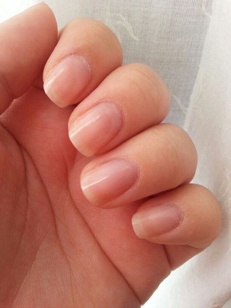 Short Natural Nails, Natural Nails Manicure, Natural Gel Nails, Long Natural Nails, Natural Nail Designs, Gel Nails At Home, Nails Natural, Almond Acrylic Nails, Nail Health