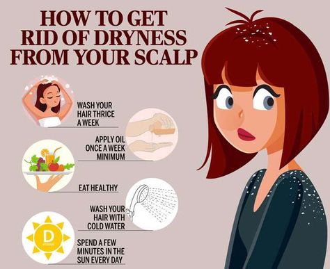 How To Prevent Dandruff, Itchy Scalp Remedy, Dog Dandruff, Home Remedies For Dandruff, Dandruff Solutions, Rid Of Dandruff, Dandruff Remedy, Getting Rid Of Dandruff, Flaky Scalp