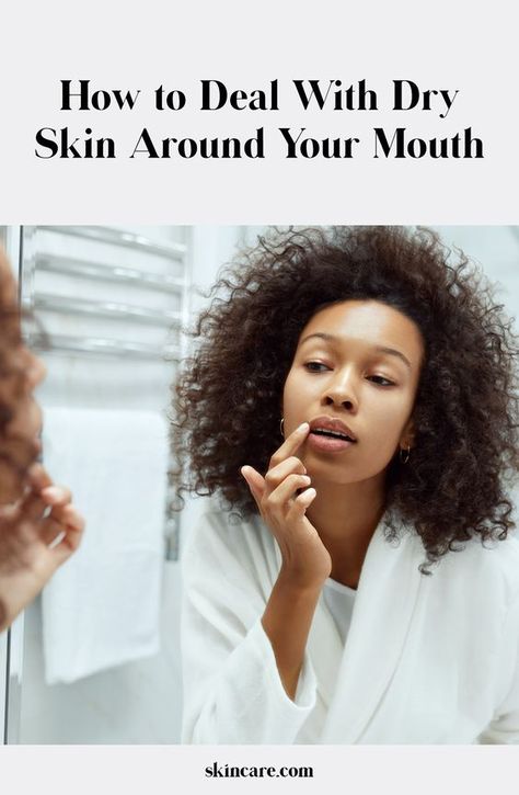 Dealing with dry skin around your mouth can be annoying and really uncomfortable. We asked a dermatologist what causes this skin-care problem and how to fix it. Dryness Around Mouth, Extremely Dry Skin On Face, Dry Skin Around Mouth, Dry Patches On Face, Jeera Water Recipe, Dry Skincare, Body Flush, Face Routine, Dry Skin On Face